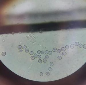 coccidia under the microscope