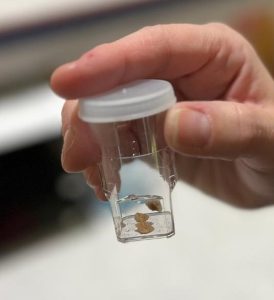 Bladder stones